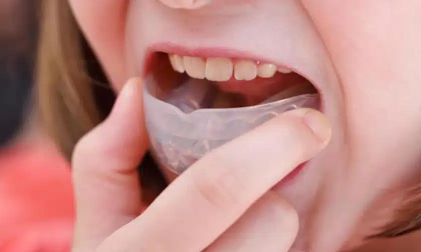 How To Wear A Mouth Guard Correctly For The Best Protection