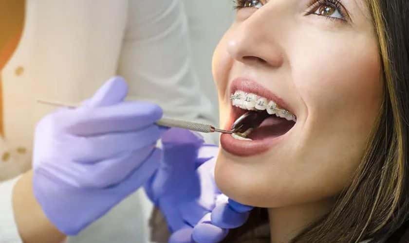 Maintaining Oral Health During Orthodontic Treatment In Knoxville