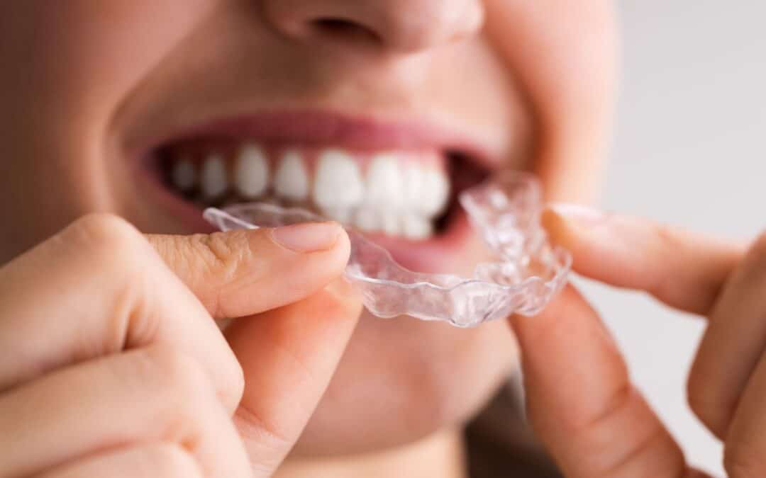 Straighten Your Smile Discreetly: Clear Aligners in Knoxville