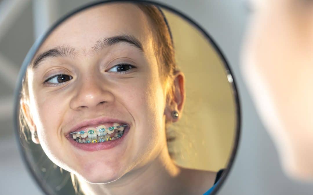 Smile More, Live More: How Orthodontics Can Transform Your Life